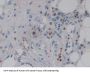 Colony Stimulating Factor 2 Receptor Alpha (CSF2Ra) Antibody