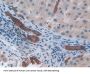 Growth Regulated Oncogene beta Antibody