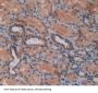 Growth Regulated Oncogene beta Antibody