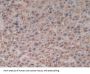 Citrate Synthase (CS) Antibody
