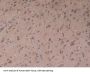 Citrate Synthase (CS) Antibody