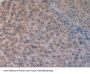 Citrate Synthase (CS) Antibody