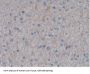 Syndecan 1 (SDC1) Antibody