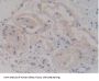 Syndecan 1 (SDC1) Antibody