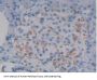 Syndecan 1 (SDC1) Antibody