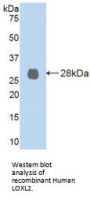 Lysyl Oxidase Like Protein 2 (LOXL2) Antibody