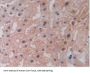 Lysyl Oxidase Like Protein 2 (LOXL2) Antibody