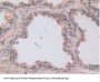 Lysyl Oxidase Like Protein 2 (LOXL2) Antibody