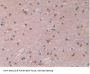 Lysyl Oxidase Like Protein 2 (LOXL2) Antibody