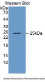 Trehalase Antibody