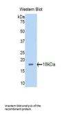Polybromo 1 (PBRM1) Antibody