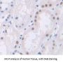 Polybromo 1 (PBRM1) Antibody