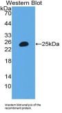 Inter Alpha-Globulin Inhibitor H3 (ITIH3) Antibody