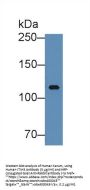 Inter Alpha-Globulin Inhibitor H3 (ITIH3) Antibody
