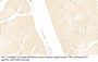 Inter Alpha-Globulin Inhibitor H3 (ITIH3) Antibody