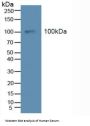 Angiopoietin-1 Receptor / TIE2 (TEK) Antibody
