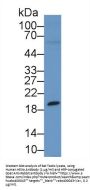 Hexosaminidase A Alpha (HEXa) Antibody
