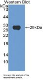 Hexosaminidase A Alpha (HEXa) Antibody