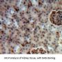 Hexosaminidase A Alpha (HEXa) Antibody