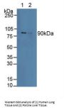 Calnexin (CANX) Antibody