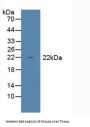 Glutathione Peroxidase 1 Antibody
