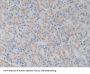 Glutathione Peroxidase 1 Antibody