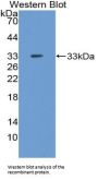 Neuronal Pentraxin II (NPTX2) Antibody