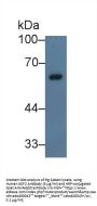 Neutrophil Cytosolic Factor 2 Antibody