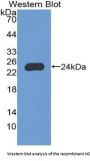 Neutrophil Cytosolic Factor 2 Antibody