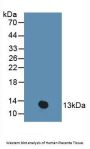 Protein Kinase Inhibitor beta Antibody