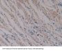 Protein Kinase Inhibitor beta Antibody