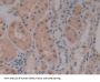 Protein Kinase Inhibitor beta Antibody