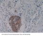Protein Kinase Inhibitor beta Antibody