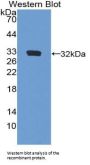 Fibrillin 3 (FBN3) Antibody