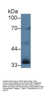 Inhibin Alpha (INHA) Antibody
