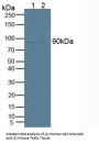 85 KDa Calcium-Independent Phospholipase A2 (PLA2G6) Antibody