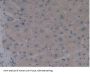 5'-AMP-Activated Protein Kinase Catalytic Subunit Alpha-1 (PRKAA1) Antibody