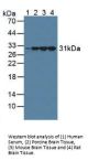Calretinin (CALB2) Antibody