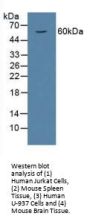 Macrophage Migration Inhibitory Factor (MIF) Antibody