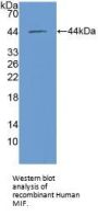 Macrophage Migration Inhibitory Factor (MIF) Antibody
