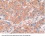 Macrophage Migration Inhibitory Factor (MIF) Antibody
