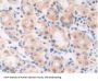 Macrophage Migration Inhibitory Factor (MIF) Antibody