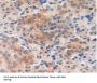 Macrophage Migration Inhibitory Factor (MIF) Antibody