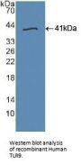 Toll Like Receptor 9 (TLR9) Antibody