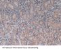 Toll Like Receptor 9 (TLR9) Antibody