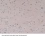 Toll Like Receptor 9 (TLR9) Antibody