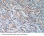 Cluster of Differentiation 276 (CD276) Antibody