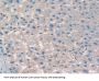 Cluster of Differentiation 276 (CD276) Antibody