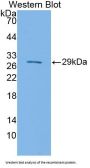 Signal Regulatory Protein Beta 1 (SIRPb1) Antibody