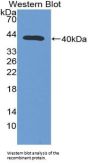 Centaurin Alpha 1 (CENTa1) Antibody